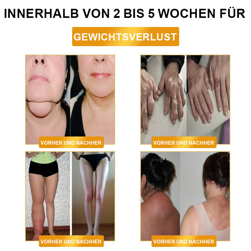 🎉🎉Begrenset tidsrabatt⚕️𝗨𝗹𝘁𝗿𝗮𝘀𝗼𝗻𝗶𝘀𝗸 𝗙𝗲𝘁𝘁𝗳𝗼𝗿𝗯𝗿𝗲𝗻𝗻𝗶𝗻𝗴 ＆ 𝗙𝗷𝗲𝗿𝗻𝗶𝗻𝗳𝗿𝗮𝗿ø𝗱 𝗕𝗹𝗼𝗱𝘀𝘂𝗸𝗸𝗲𝗿𝗯𝗮𝗹𝗮𝗻𝘀𝗲𝗿𝗶𝗻𝗴 𝗗𝗲𝘁𝗼𝘅 𝗔𝗿𝗺𝗯å𝗻𝗱 - 𝗘𝗻𝗲𝗿𝗴𝗶𝗯𝗮𝗹𝗮𝗻𝘀𝗲