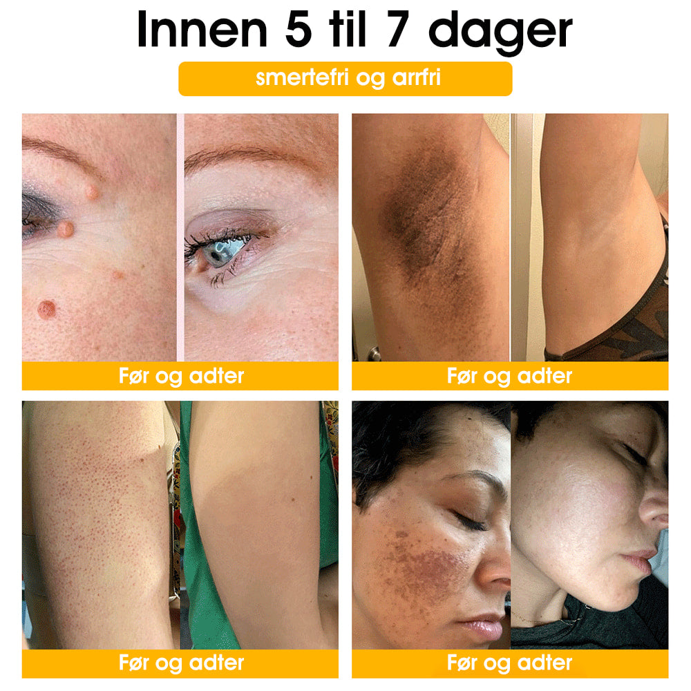 👩‍⚕️🔥 𝐓𝐧𝐧𝐞𝐝𝐞𝐲™ 𝐁𝐢𝐞𝐠𝐢𝐟𝐭𝐞𝐧 𝐕𝐨𝐫𝐭𝐞- 𝐨𝐠 𝐌𝐨𝐥𝐞𝐛𝐞𝐡𝐚𝐧𝐝𝐥𝐢𝐧𝐠𝐬𝐤𝐫𝐞𝐦 (𝐀𝐍𝐁𝐄𝐅𝐀𝐋𝐓 𝐀𝐕 𝐁𝐀𝐃)