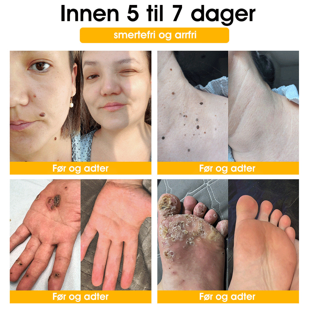 👩‍⚕️🔥 𝐓𝐧𝐧𝐞𝐝𝐞𝐲™ 𝐁𝐢𝐞𝐠𝐢𝐟𝐭𝐞𝐧 𝐕𝐨𝐫𝐭𝐞- 𝐨𝐠 𝐌𝐨𝐥𝐞𝐛𝐞𝐡𝐚𝐧𝐝𝐥𝐢𝐧𝐠𝐬𝐤𝐫𝐞𝐦 (𝐀𝐍𝐁𝐄𝐅𝐀𝐋𝐓 𝐀𝐕 𝐁𝐀𝐃)